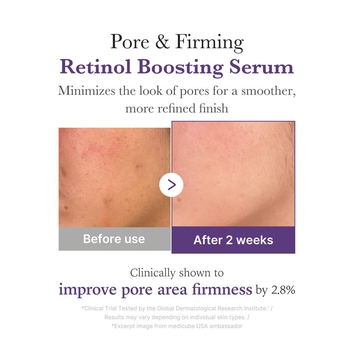 Retinol NMN Boosting Serum 30ml – bild 4