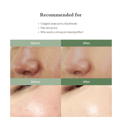 Premium Quick Step Sebum Cleanser