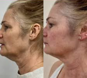 Skärmavbild 2026-03-12 kl. 23.08.21.png